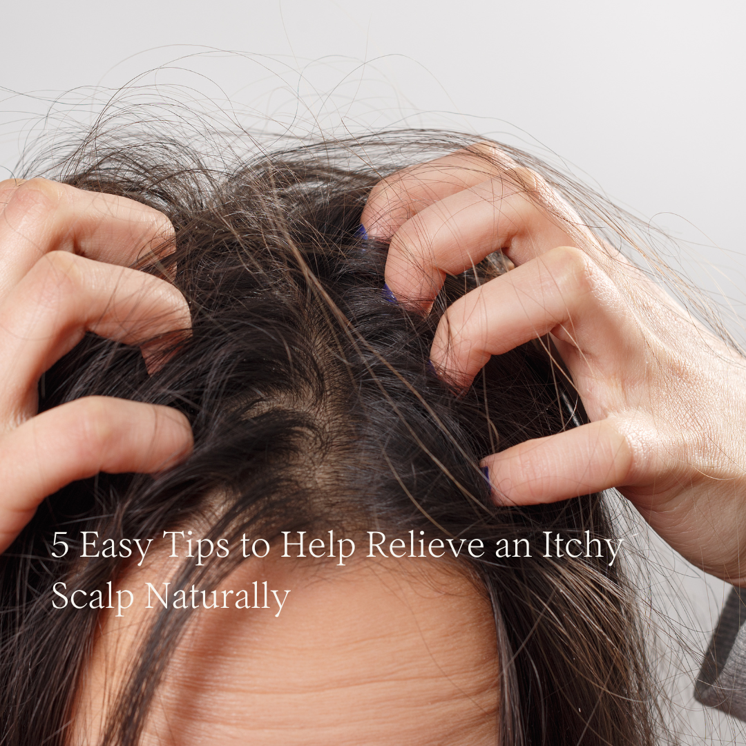 5 Easy Tips to Help Relieve an Itchy Scalp Naturally
